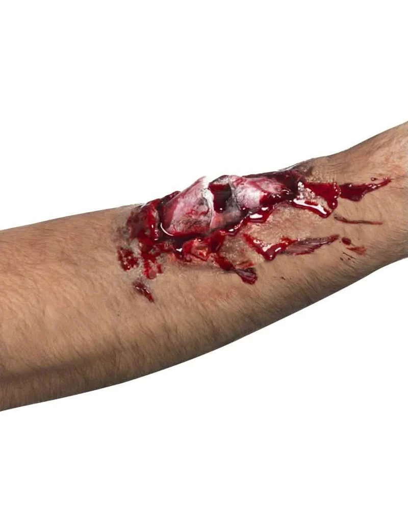 Armwunde für Erwachsene