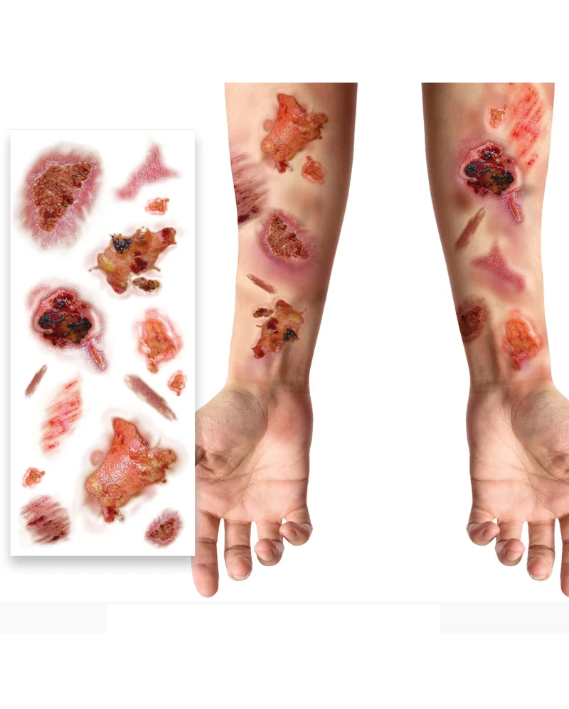 Infizierte Wunden Klebetattoos